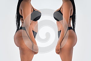 Tummy tuck, fat body before and after weight loss and liposuction on gray background, black African woman, plastic surgery concept