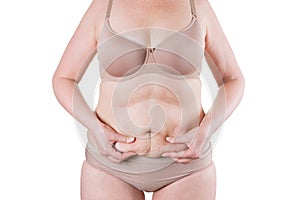 Tummy tuck, flabby skin on a fat belly, plastic surgery concept