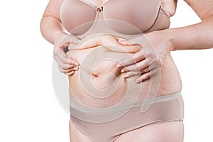 Tummy tuck, flabby skin on a fat belly, plastic surgery concept