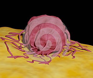 Tumor cell on the host cell isolated