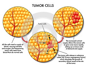 Tumor cells photo