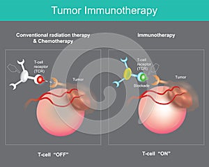 Tumor Immunotherapy. Cancer treatment photo