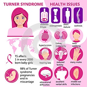 Turner Syndrome infographic vector. Signs, health issues. Short stature, kidney irregularity, reduced fertility, many moles,