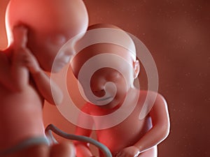 Twin fetuses - week 30