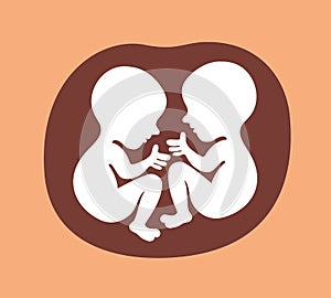 Twins - two unborn babies are in uterus of mother.