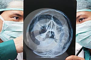 Two Asian surgeon discuss over skeleton roentgen photo