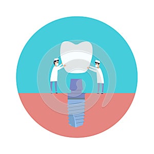 Two dentists perform dental implantation: install the implant on the abutment. Vector illustration, in a flat style