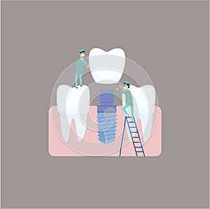 Two dentists perform dental implantation: install the implant on the abutment. Vector illustration, in a flat style