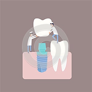 Two dentists perform dental implantation: install the implant on the abutment. Vector illustration, in a flat style photo