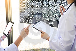 Two doctors analyzing a scan or x-ray film or explains a CT sca