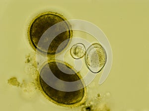 Two eggs of Toxocara cati and two oocysts of Isospora felis under the microscope photo