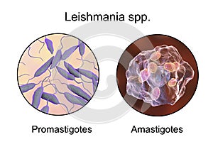 Two forms of Leishmania parasites