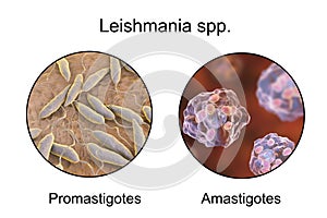 Two forms of Leishmania parasites