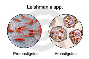 Two forms of Leishmania parasites