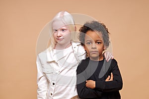Two friendly afro american and albino children stand together