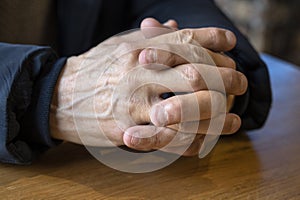 Two hands with bitten and ugly nails