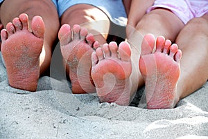 Two Pair of Bare Feet