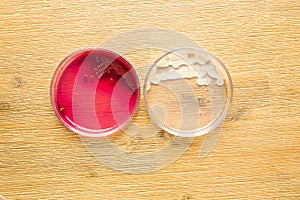 Two Petri plates with growing bucterial cultures in medical laboratory