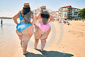 Two plus size overweight women showing legs vascular disease of varicose and thrombosis at the beach