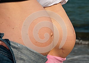 Two Pregnant Women relaxing at the Beach in Italy