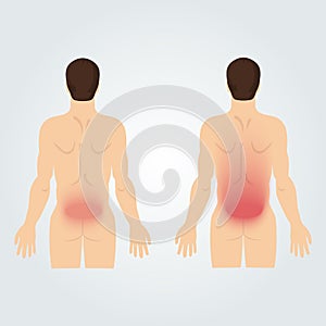 Two silhouettes of men from the back: increased back pain.