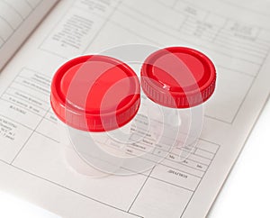 Two steril medical containers photo