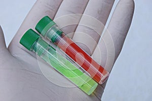 Two test tubes with colored liquids on an open palm in the glove