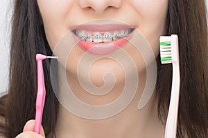 Two types of brush for cleaning teeth with dental braces. Brackets on the teeth after whitening. Self-ligating brackets with metal