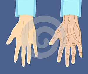 Two types of hand , old and young, vector illustration