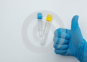 Two vacuum tubes for collection and blood samples with sodium citrate in blue gloves for laboratory.