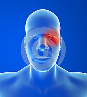 Type headache: Cluster