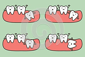 Type of wisdom tooth affect to other teeth