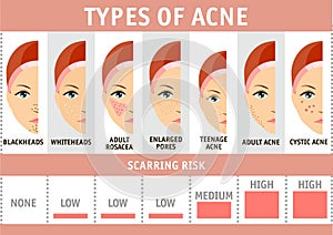 Types of acne infographics. Vector illustration types of acne, pimples, skin pores, blackhead, whitehead, scar