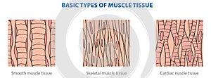 Muscle tissue
