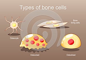 Types of bone cells. Osteocyte, lining cells, osteoblast, osteoclast