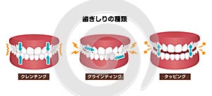 Types of bruxism teeth grinding vector illustration