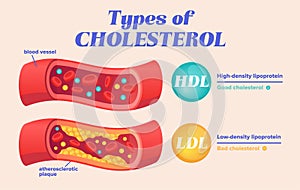 Types of cholesterol comparison with HDL and LDL photo