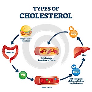 Types of cholesterol educational cycle scheme from fatty food to LDL artery