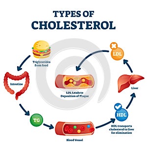 Types of cholesterol educational cycle scheme from fatty food to LDL artery photo