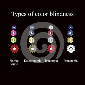 Types of color blindness. Eye color perception. Vector illustration on a black background