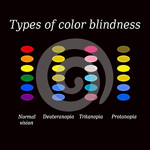 Types of color blindness. Eye color perception. Vector illustration on a black background photo