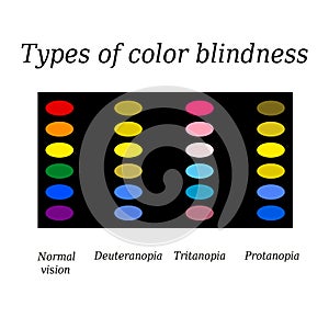 Types of color blindness. Eye color perception. Vector illustration on isolated background