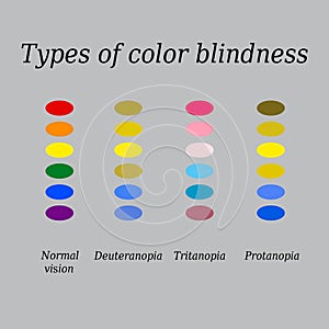 Types of color blindness. Eye color perception. Vector illustration on a gray background photo