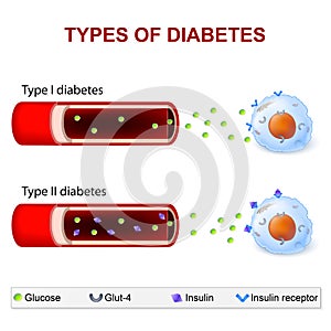 Types of Diabetes photo