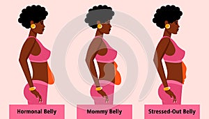 Types of female tummies for African American women. Menopausal hormonal belly, bloating belly and stressed-out belly photo