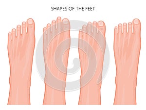 Types of the forefoot and toes photo