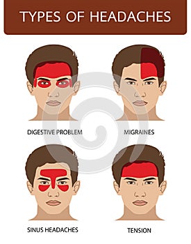 Types of headaches migraine, sinus, tension, digestive, illustration on white background