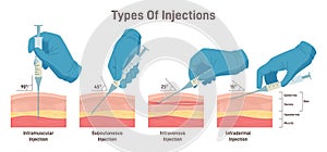 Types of injections. Guide to injecting medication into skin. Doctor holding