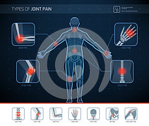 Types of joint pain infographic