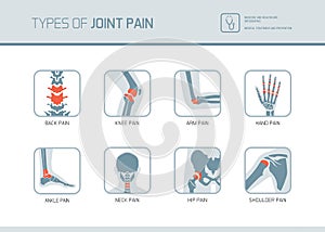 Types of joint pain photo